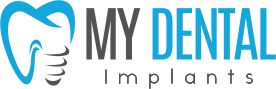 My Dental Implants Logo