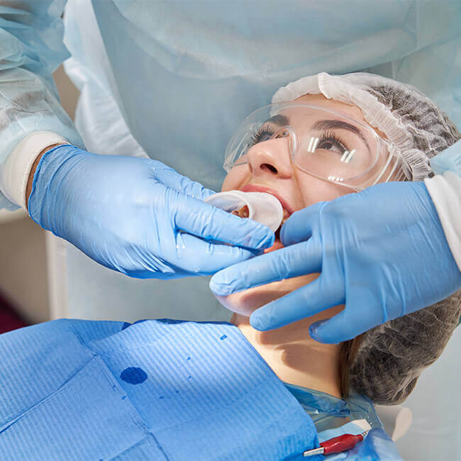Smile Makeover Auckland