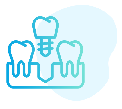 Implant supported Bridge