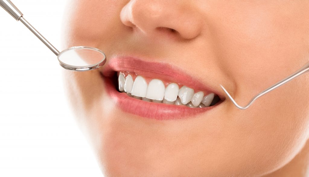 Smile Makeover Auckland