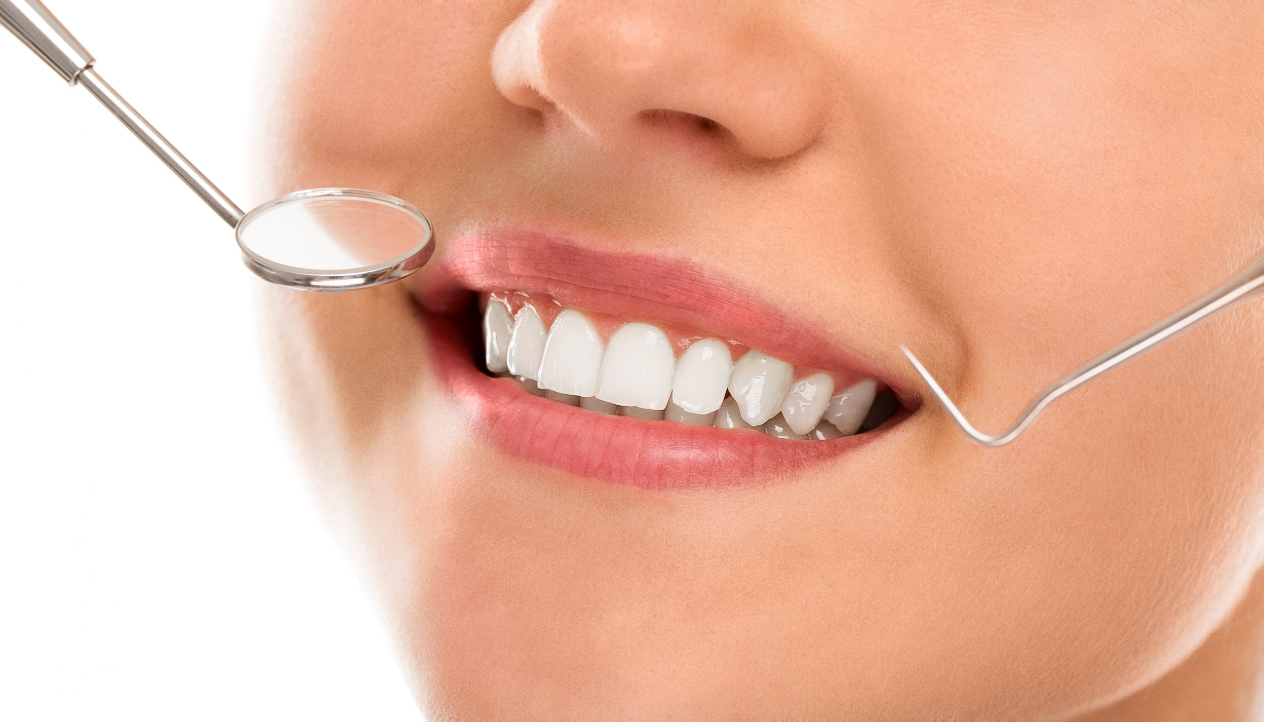 Smile Makeover Auckland