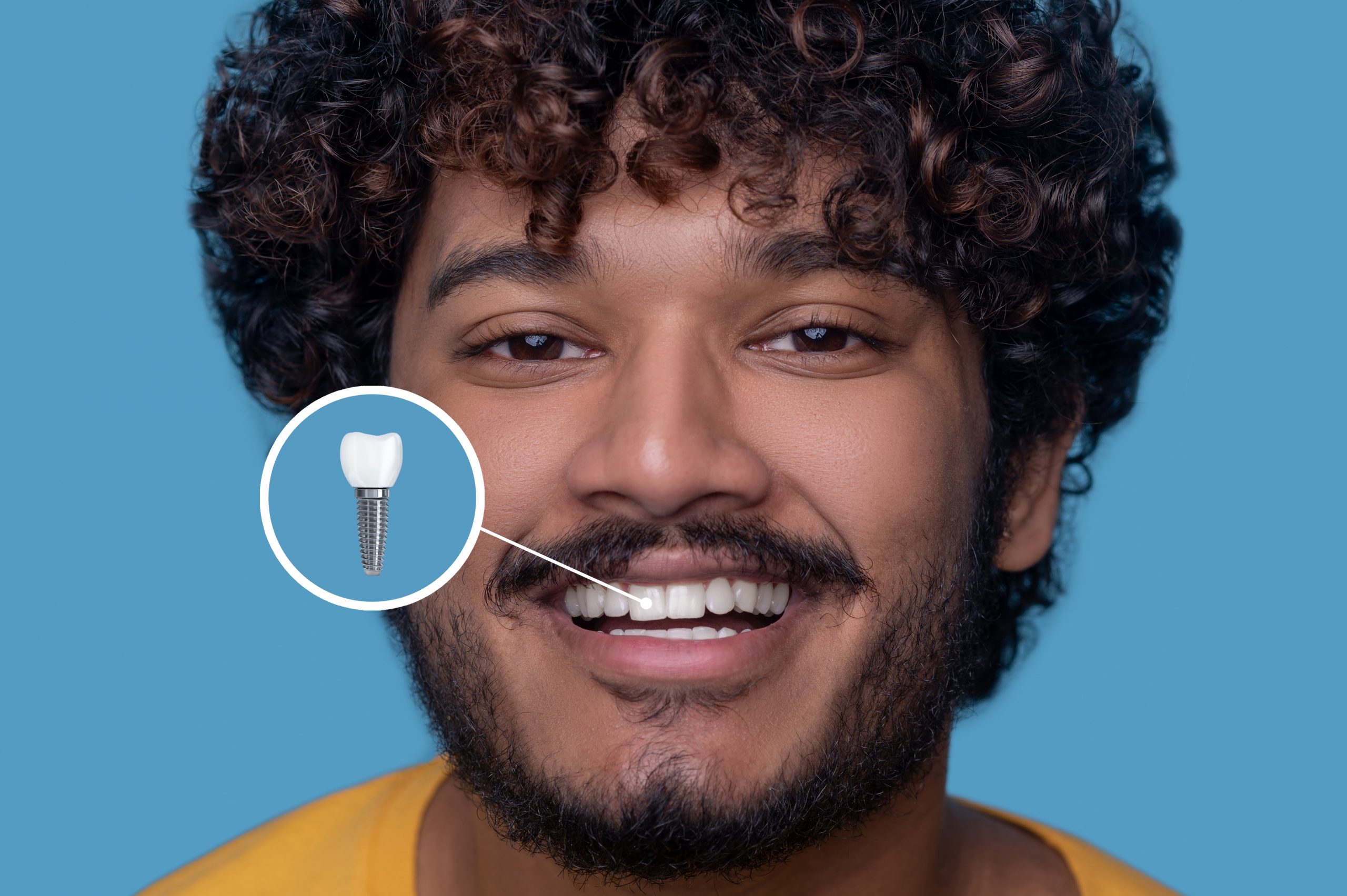 Dental Implant Procedure Auckland