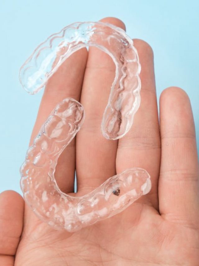 cropped-Invisible-removable-braces-cosmetic-makeover.jpg