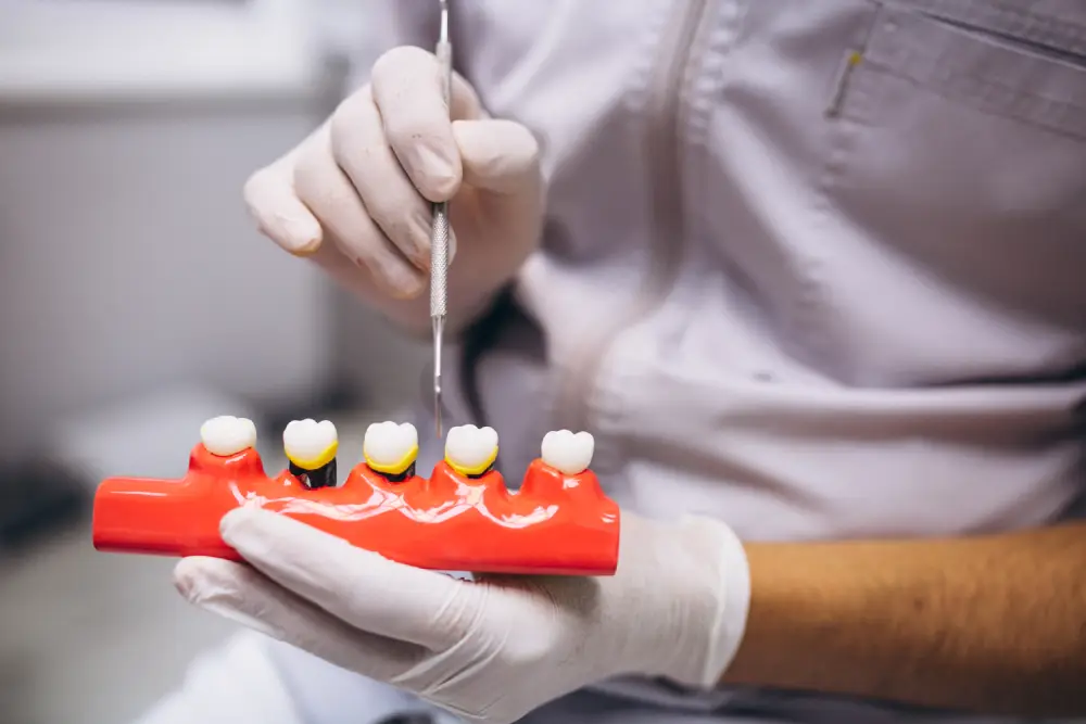 Dental Implants